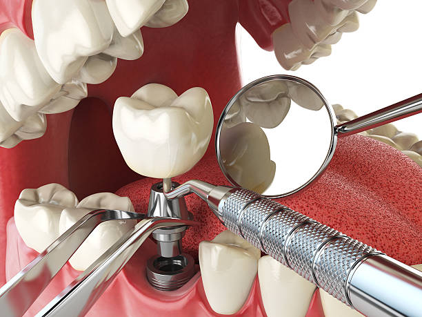 Best Weekend Emergency Dentist in East Camden, SC